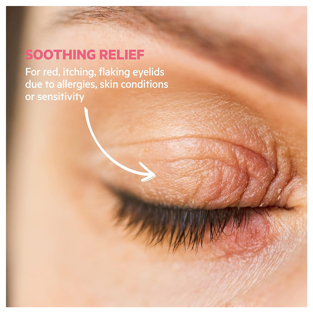 كريم سڤر بالبيبرال لعلاج تهيج الجفون ومحيط العين 15 مل