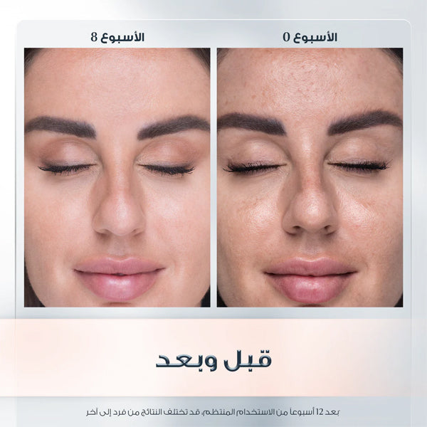 Eucerin Even Pigment Perfector Dual Serum 30ml