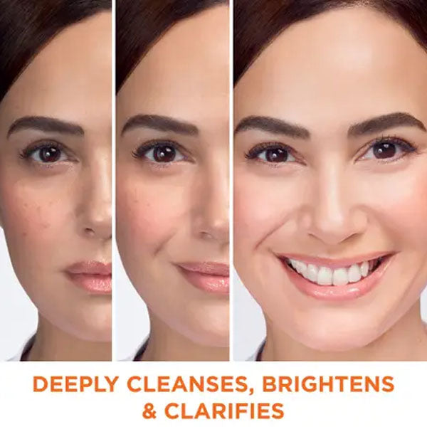 غسول غارنييه فاست فيرنس للوجه بالليمون لتفتيح البشرة 100 مل