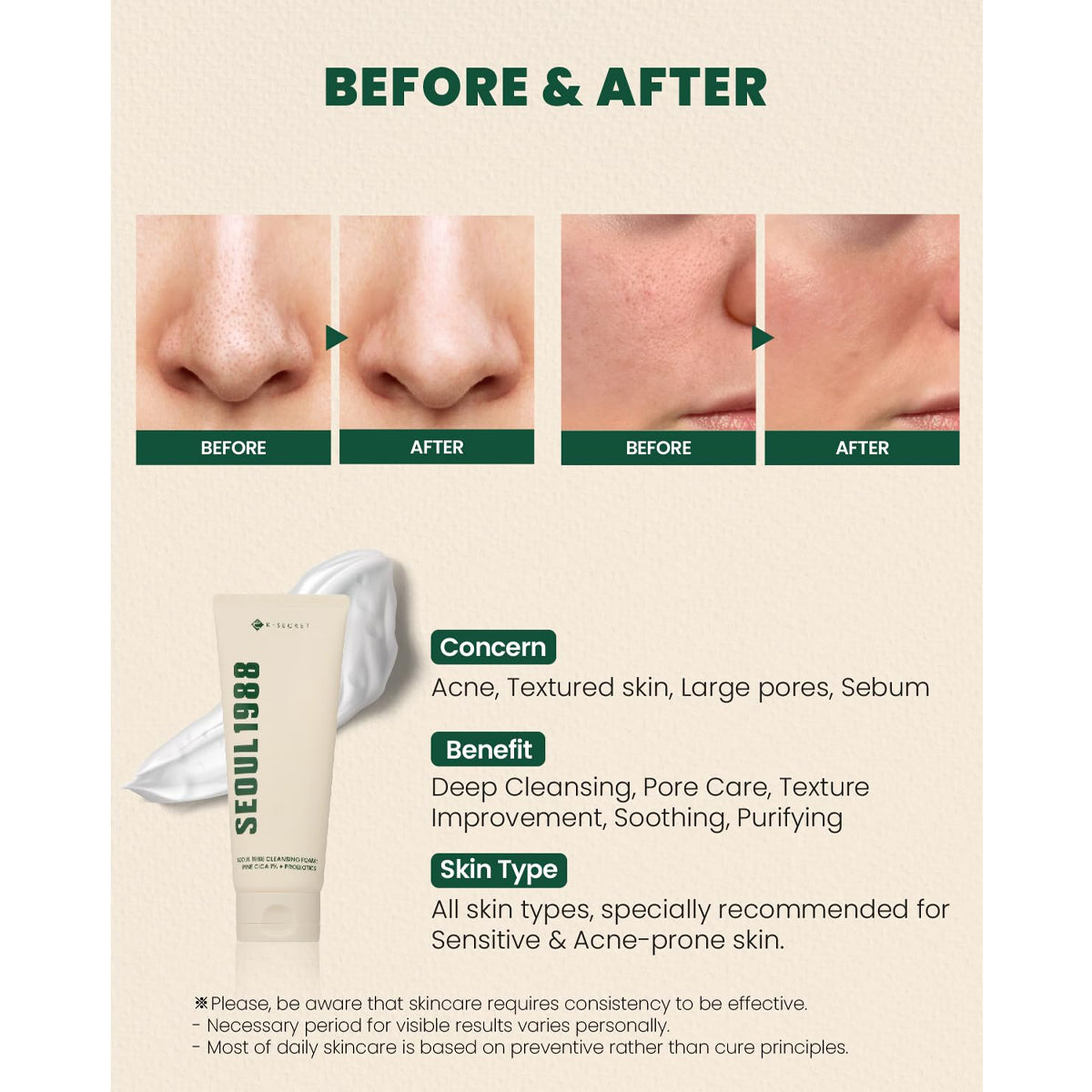 K-Secret Seoul 1988 Cleansing Foam Pine Cica 1% + Probiotics 150ml