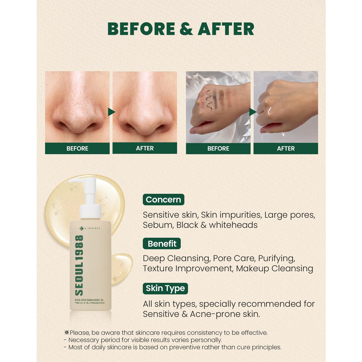 K-Secret Seoul 1988 Cleansing Oil Pine Cica 1% + Probiotics 200ml