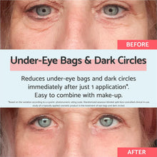 Load image into Gallery viewer, Remescar Eye Bags/dark Circles 8ml
