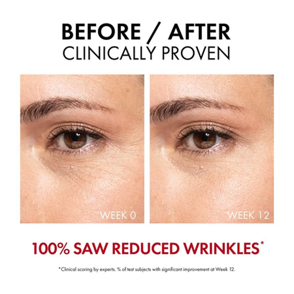 Vichy Liftactiv Collagen Specialist 16 Bonding Serum 30ml