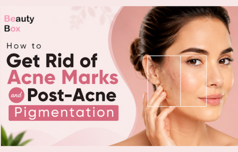 How to Get Rid of Acne Marks and Post-Acne Pigmentation