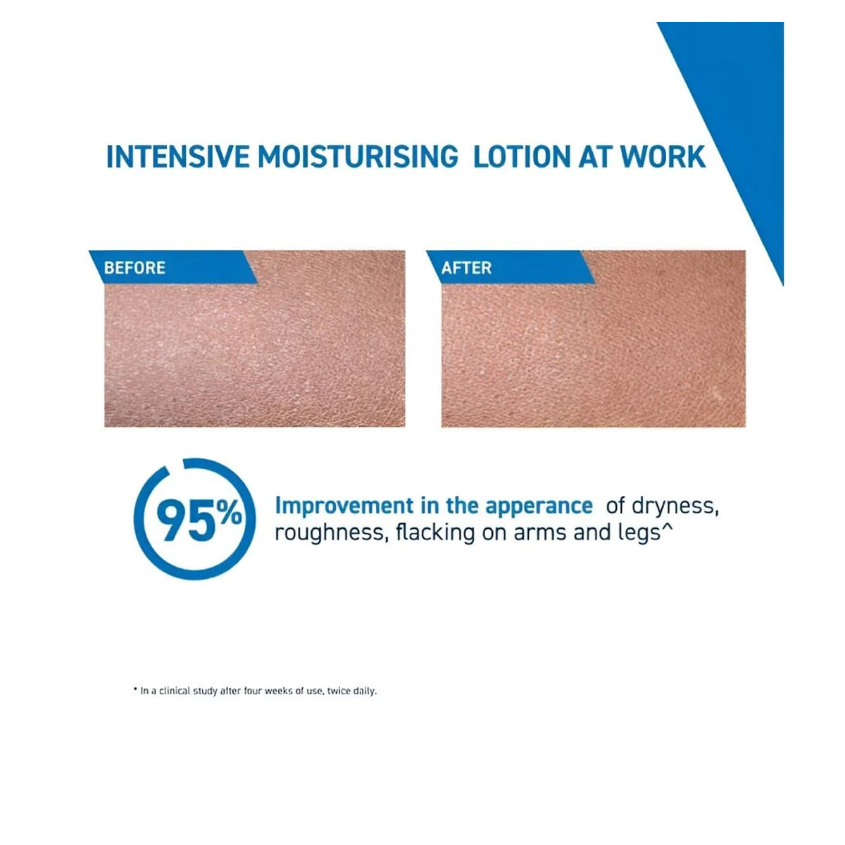 Cerave Intensive Moisturizing Lotion For Very Dry Itchy Skin 236ml