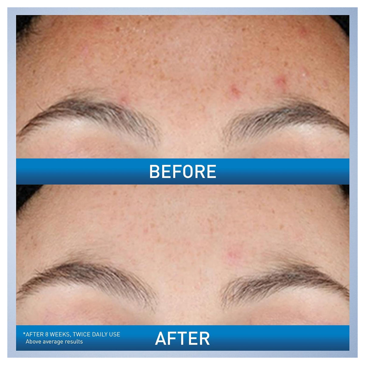 Cerave Resurfacing Retinol Serum 30ml