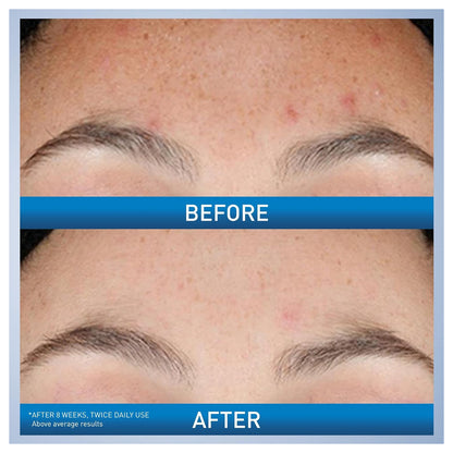 Cerave Resurfacing Retinol Serum 30ml