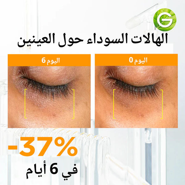 أمبولات سيروم غارنييه فاست برايت بفيتامين سي ١٢*١.٥ مل أمبولات سيروم غارنييه فاست برايت بفيتامين سي ١٢*١.٥ مل