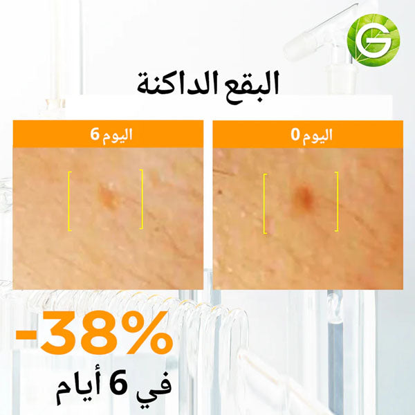 أمبولات سيروم غارنييه فاست برايت بفيتامين سي ١٢*١.٥ مل أمبولات سيروم غارنييه فاست برايت بفيتامين سي ١٢*١.٥ مل