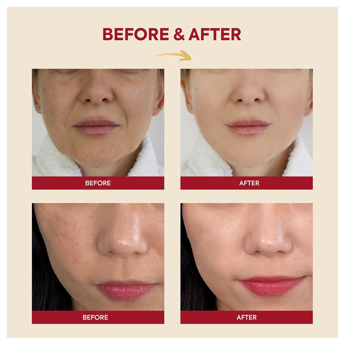 K-Secret Seoul 1988 Essence Snail Mucin 97% + Rice 100ml K-Secret Seoul 1988 Essence Snail Mucin 97% + Rice 100ml
