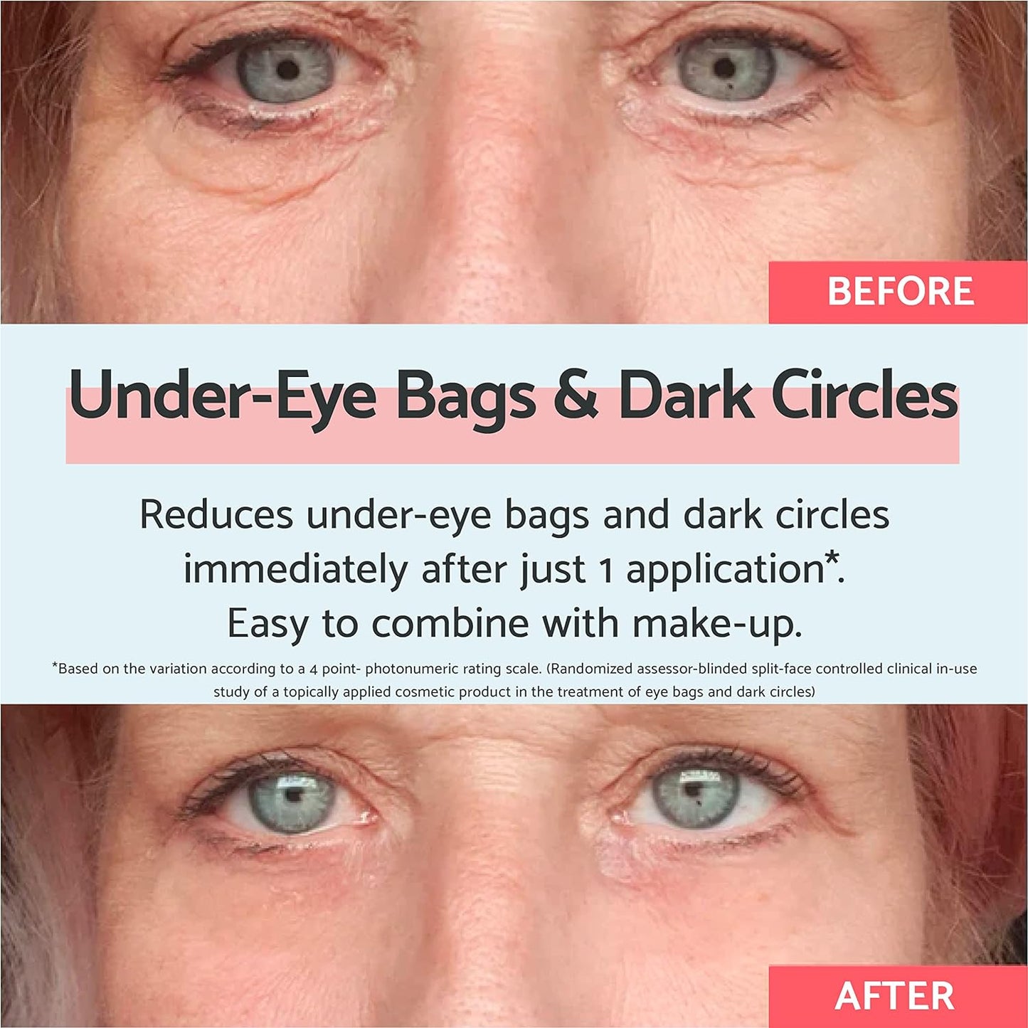 Remescar Eye Bags/dark Circles 8ml